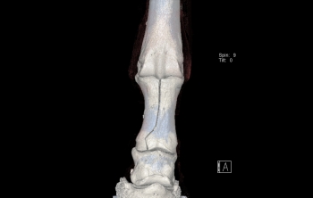 Traitement chirurgical des fractures du doigt chez le cheval, assisté par le scanner